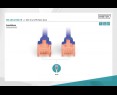 Digitus Patch cord U/UTP CAT 6 2m niebieski kabel sieciowy z RJ45 Digitus Patch cord U/UTP CAT 6 2m niebieski kabel sieciowy z RJ45